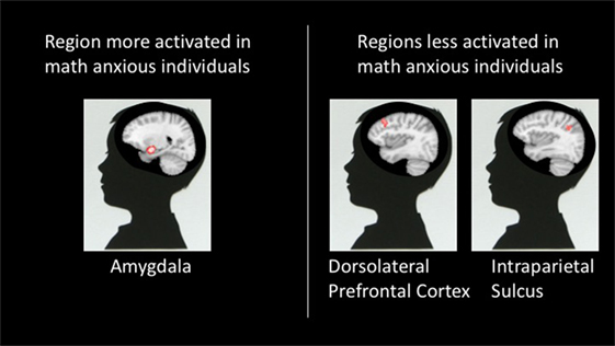 Figure 3 - this image shows the high degree of math anxiety and low individual in math, high degree of brain activation (work more 'efforts to 