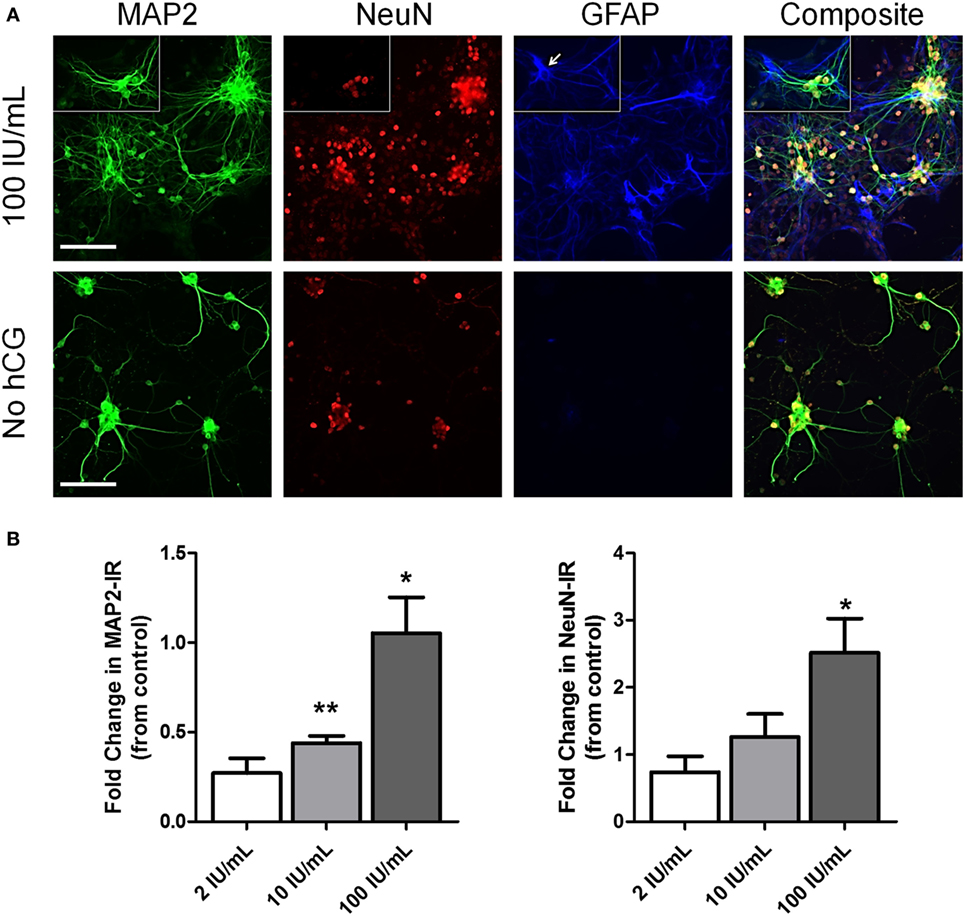 Frontiers Pretreatment With Human Chorionic Gonadotropin Protects The Neonatal Brain Against The Effects Of Hypoxic Ischemic Injury Pediatrics