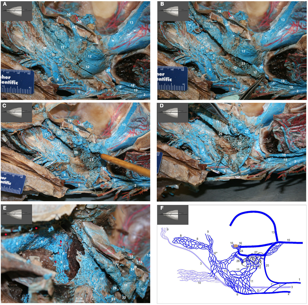 mandibular-nerve-division-and-its-relationship-with-vascular-structures-close  - NYSORA