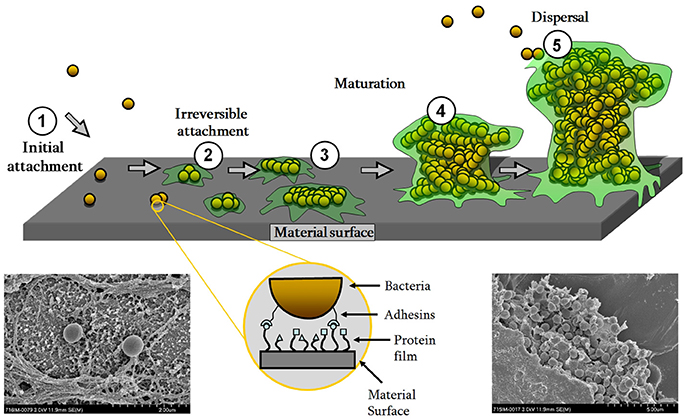 Frontiers  Selective Host Cell Death by Staphylococcus aureus: A Strategy  for Bacterial Persistence