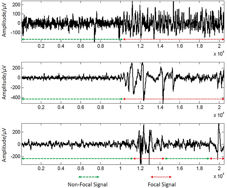 Frontiers Automatic Change Detection For Real Time Monitoring Of Eeg Signals Physiology