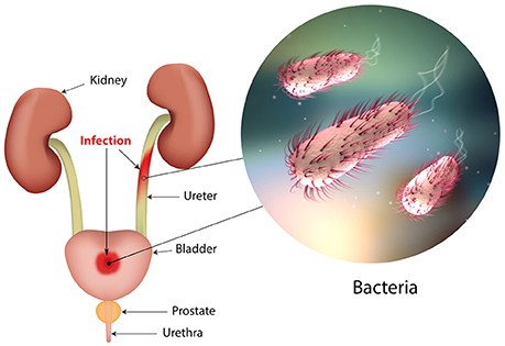 Frontiers Uropathogenic Escherichia Coli Upec Infections Virulence Factors Bladder Responses Antibiotic And Non Antibiotic Antimicrobial Strategies Microbiology