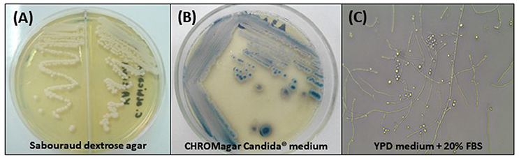 Frontiers An Update on Candida tropicalis Based on Basic and