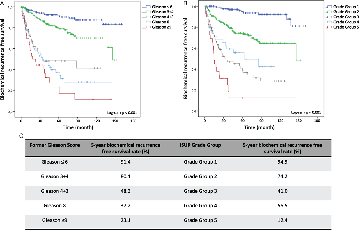 prostatic adenocarcinoma gleason score 44=8