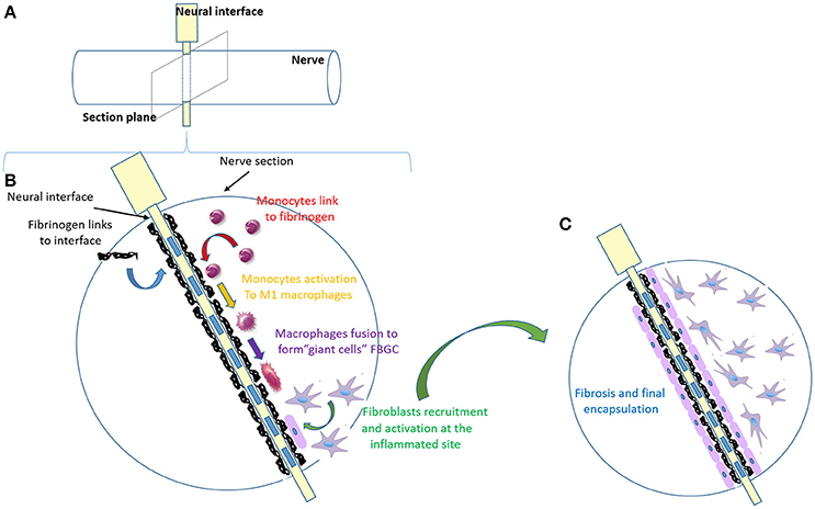 Frontiers  Foreign Body Reaction to Implanted Biomaterials and