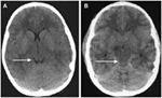 Frontiers | Anatomical and Physiological Differences between Children ...