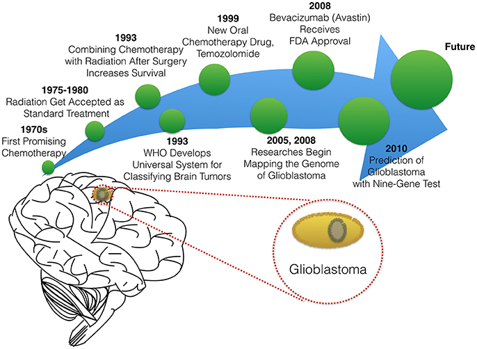 new research glioblastoma