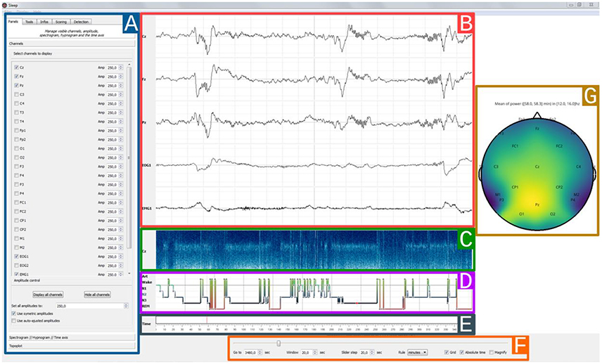 Parameter trend Modelling где находится. Brainproducts EEG Mr Layout. Software for Sound Stage visualisation. Common spatial pattern for EEG channel selection.