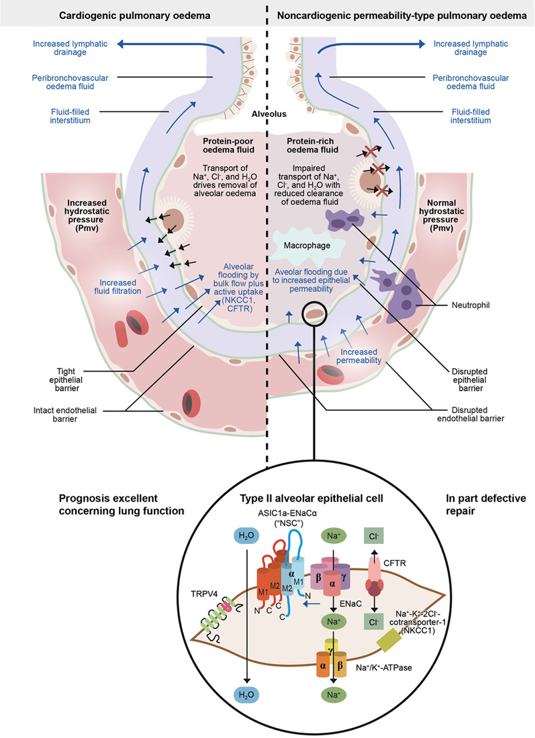 Frontiers | Cytokine–Ion Channel Interactions in Pulmonary Frontiers | Cytokine–Ion Channel Interactions in Pulmonary