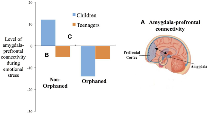 Abbildung 3 - Das Gehirn A. zeigt die Verbindung zwischen Amygdala und präfrontalem Kortex.