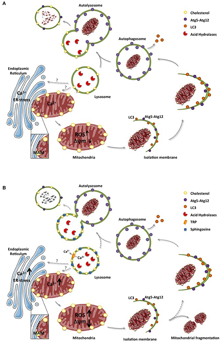 Morphology of Niemann-Pick type A metabolic storage disorder