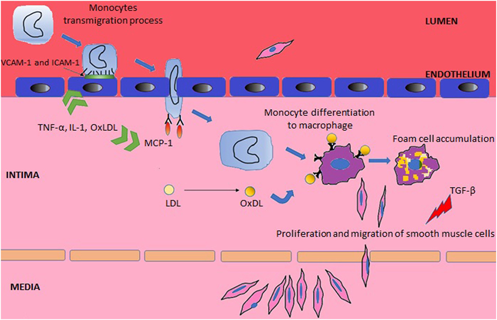 Frontiers Novel Insights In Systemic Lupus Erythematosus And Atherosclerosis Medicine