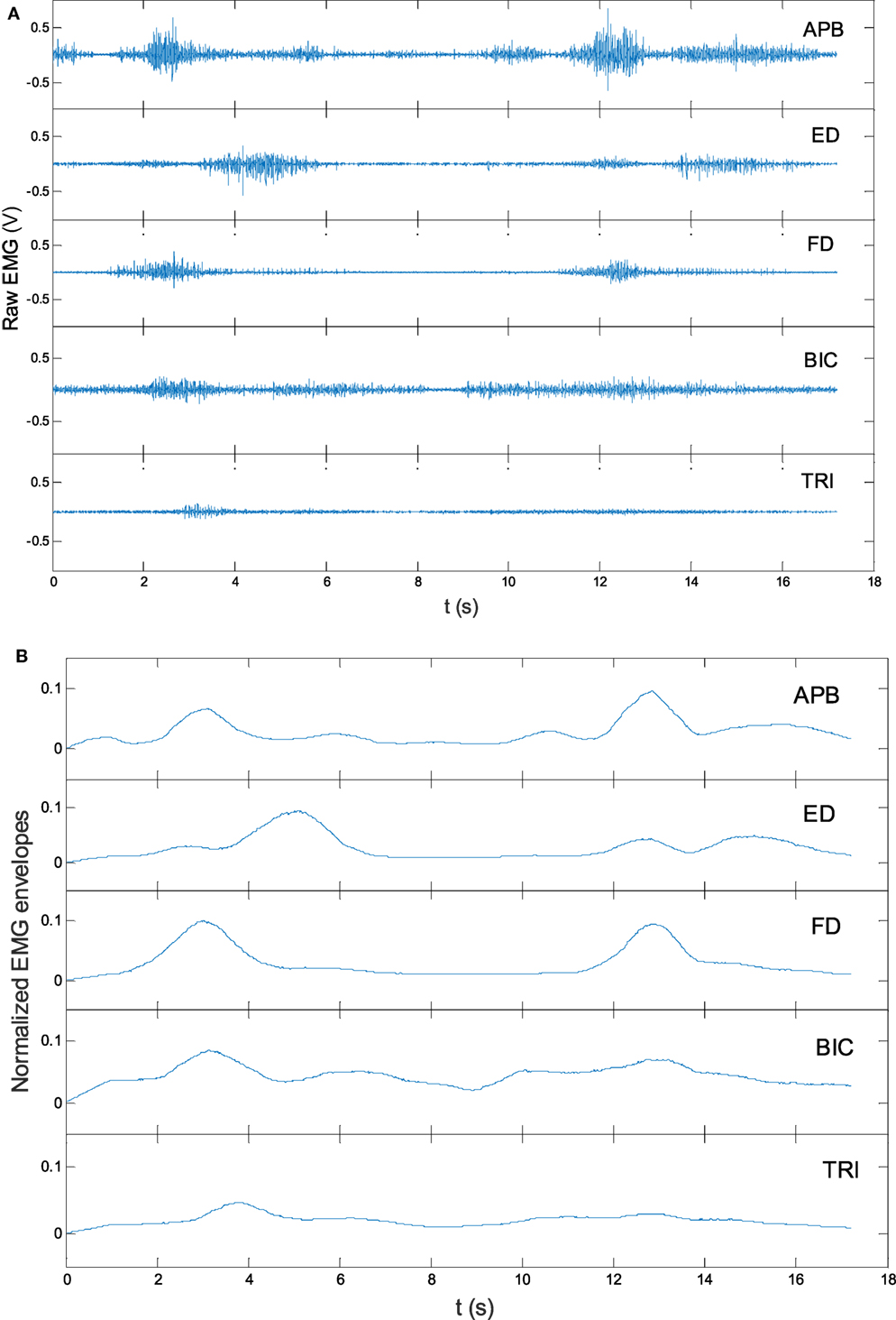 The electromyography (EMG)-driven neuromuscular electrical stimulation