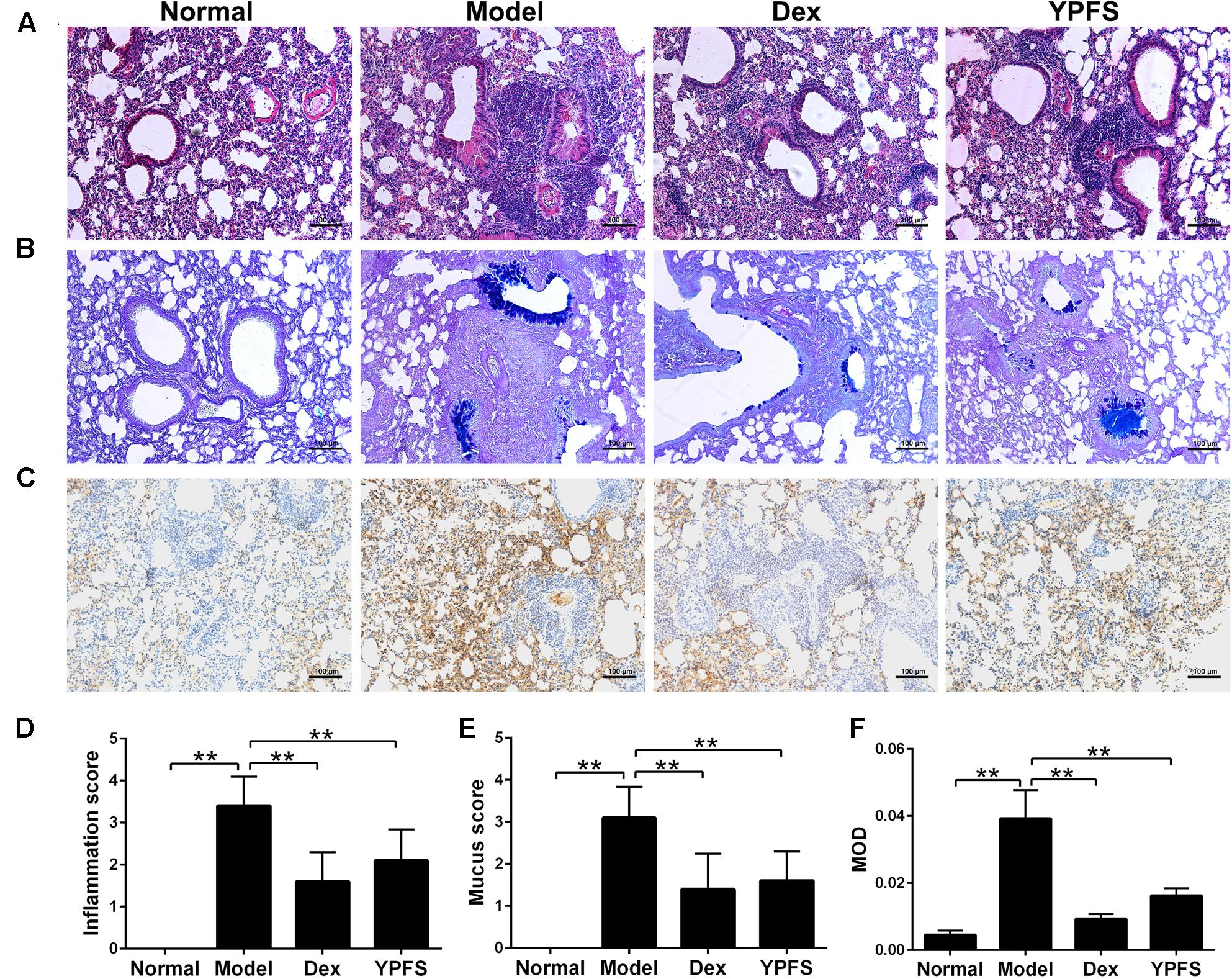 Frontiers | Yupingfeng San Inhibits NLRP3 Inflammasome to Attenuate the ...