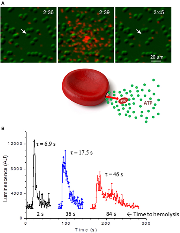 Frontiers | Effects of Hypoxia on Erythrocyte Membrane for Intravascular Hemolysis Purinergic Control of | Physiology