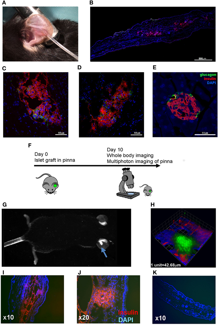 Frontiers Non Invasive Multiphoton Imaging Of Islets Transplanted Into The Pinna Of The Nod Mouse Ear Reveals The Immediate Effect Of Anti Cd3 Treatment In Autoimmune Diabetes Immunology