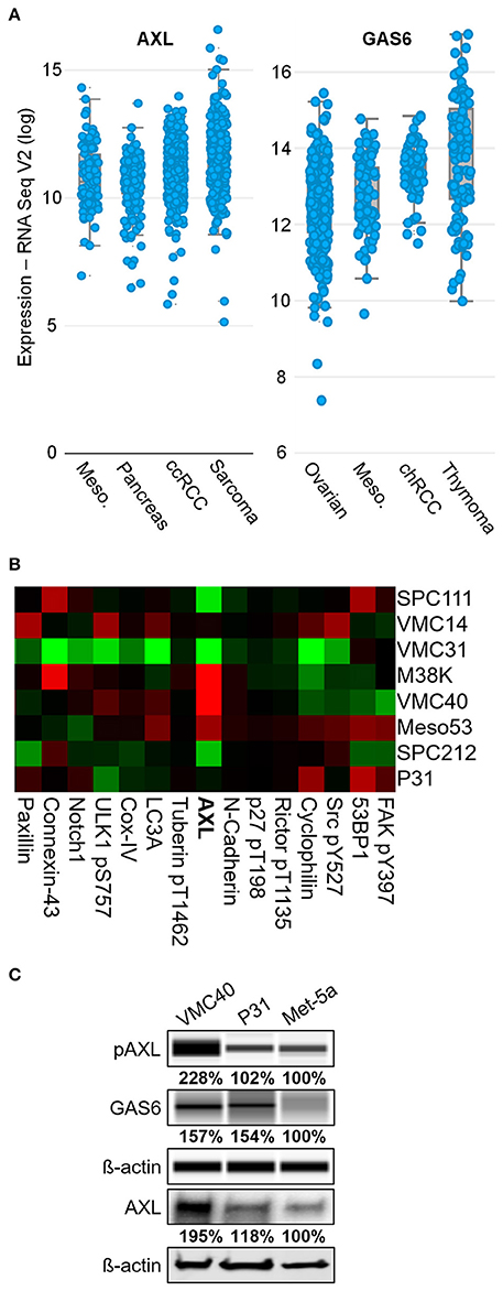 immunohistochemical diagnosis of epithelioid mesothelioma