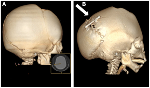 frontiersin strategies regenerative disorders craniofacial figure fphys