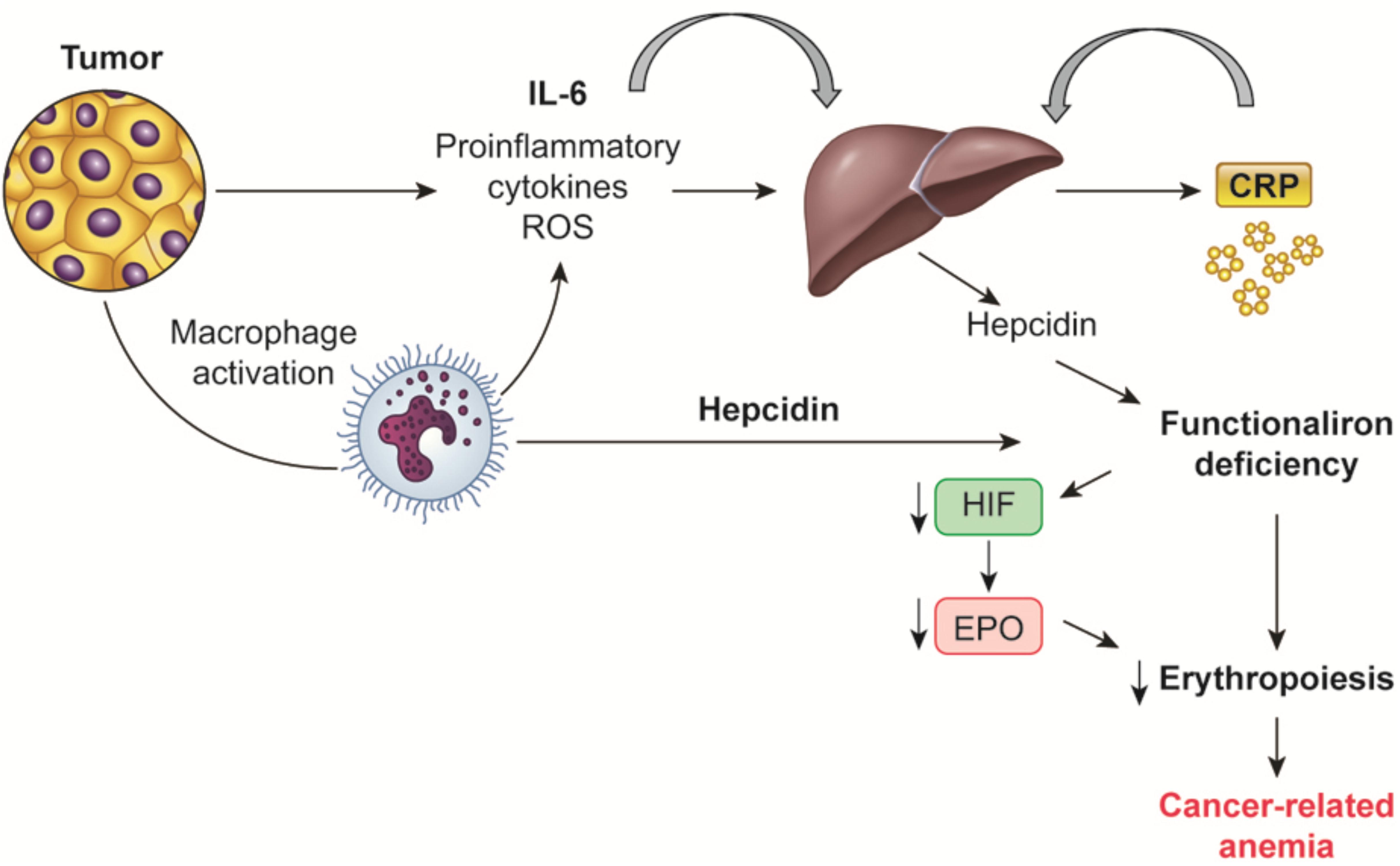 sideroblastic anemia pathophysiology