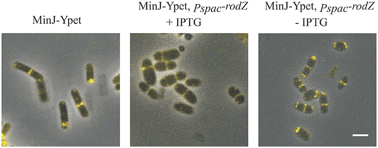 Frontiers | Interaction of the Morphogenic Protein RodZ with the ...