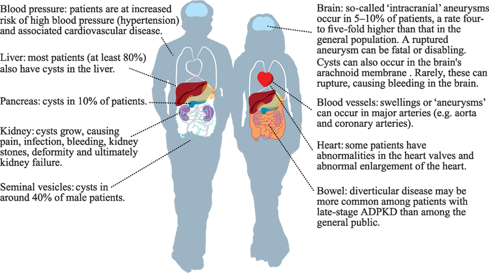 image of where kidney pain is felt