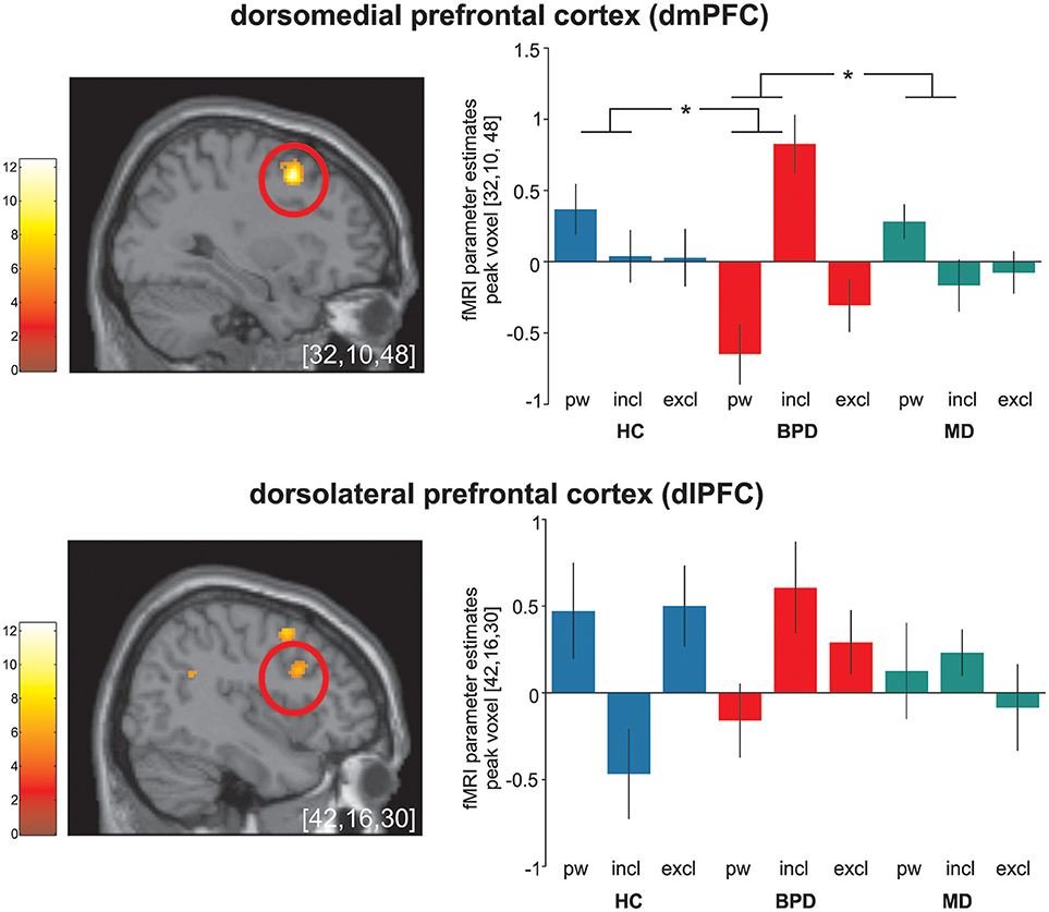 Key Brain Activity Absent in Borderline Personality Disorder - Neuroscience  News