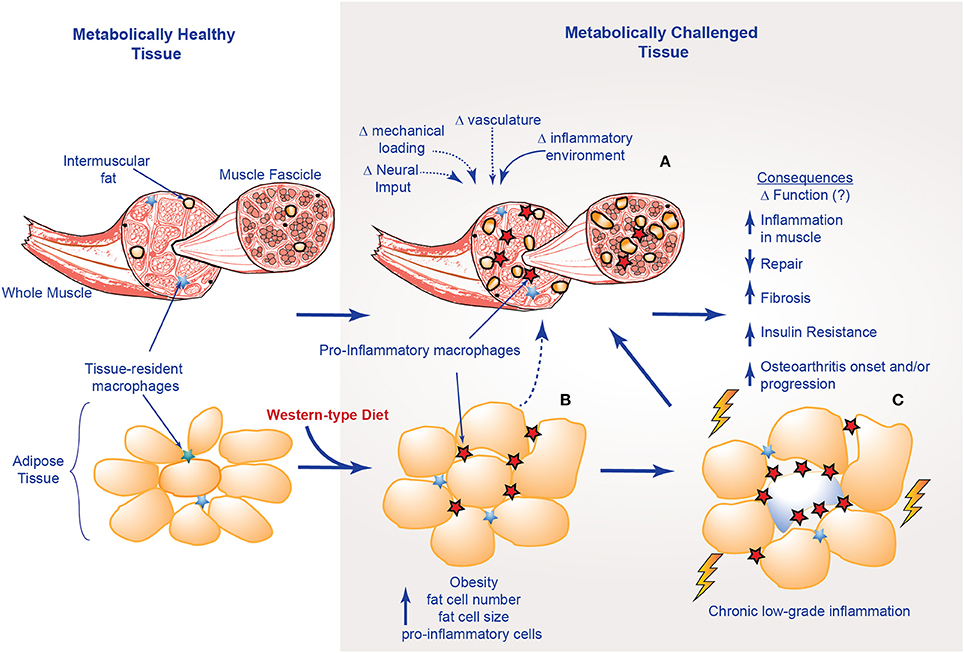 Inflamacion del utero causas