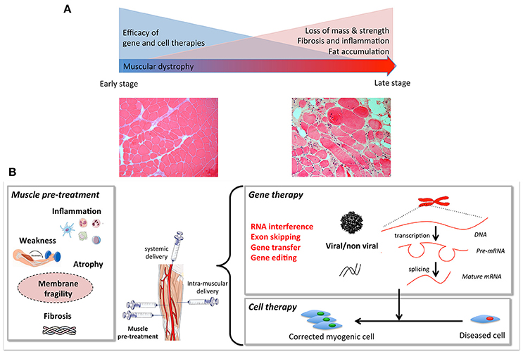 duchenne muscular dystrophy gene