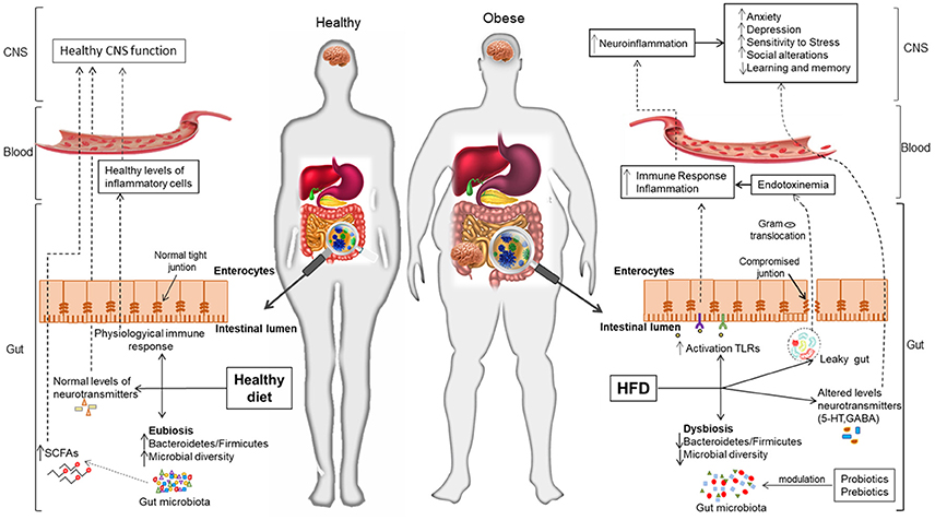 Schizophrenia and obesity: May the gut microbiota serve as a link for the  pathogenesis? - Wu - 2023 - iMeta - Wiley Online Library