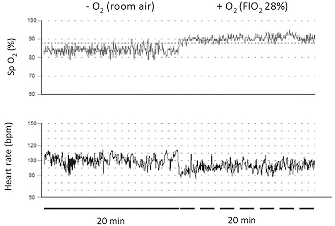 Oxygen enrichment of room air to improve well-being and productivity at  high altitude. = (Enrichissement en