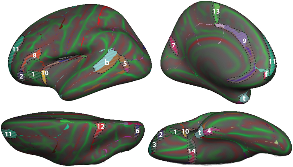 Frontiers 101 Labeled Brain Images And A Consistent Human