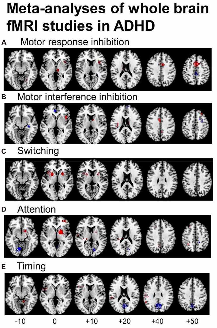 add adhd research studies