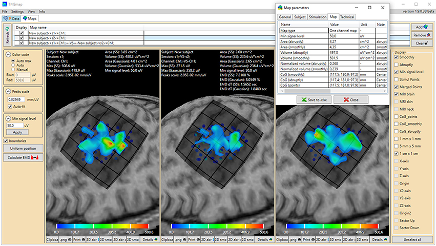 brain mapping procedure tms brain mapping procedure tms