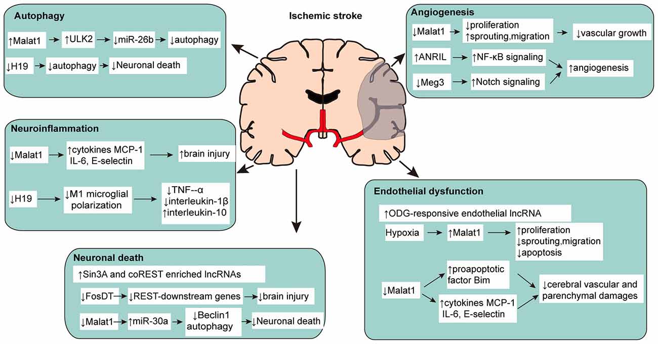 ischemic stroke pathophysiology