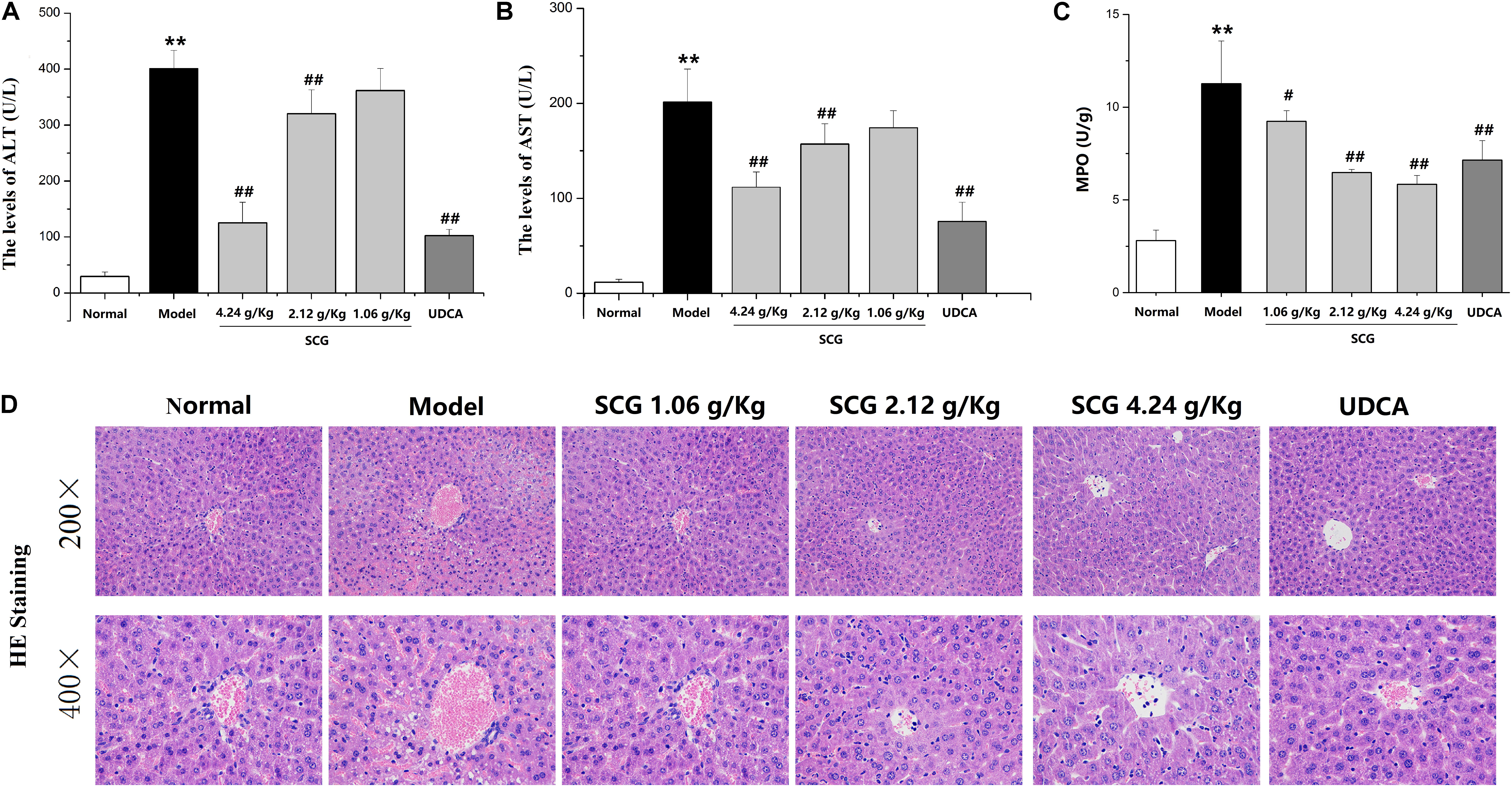 Frontiers | Hepatoprotective Effect of San-Cao Granule on Con A 