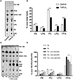 Lpc lipid Lpc lipid