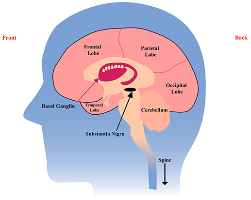 Figure 1 - Side view of the brain, sliced in half, showing the basal ganglia (red), and the substantia nigra (black).