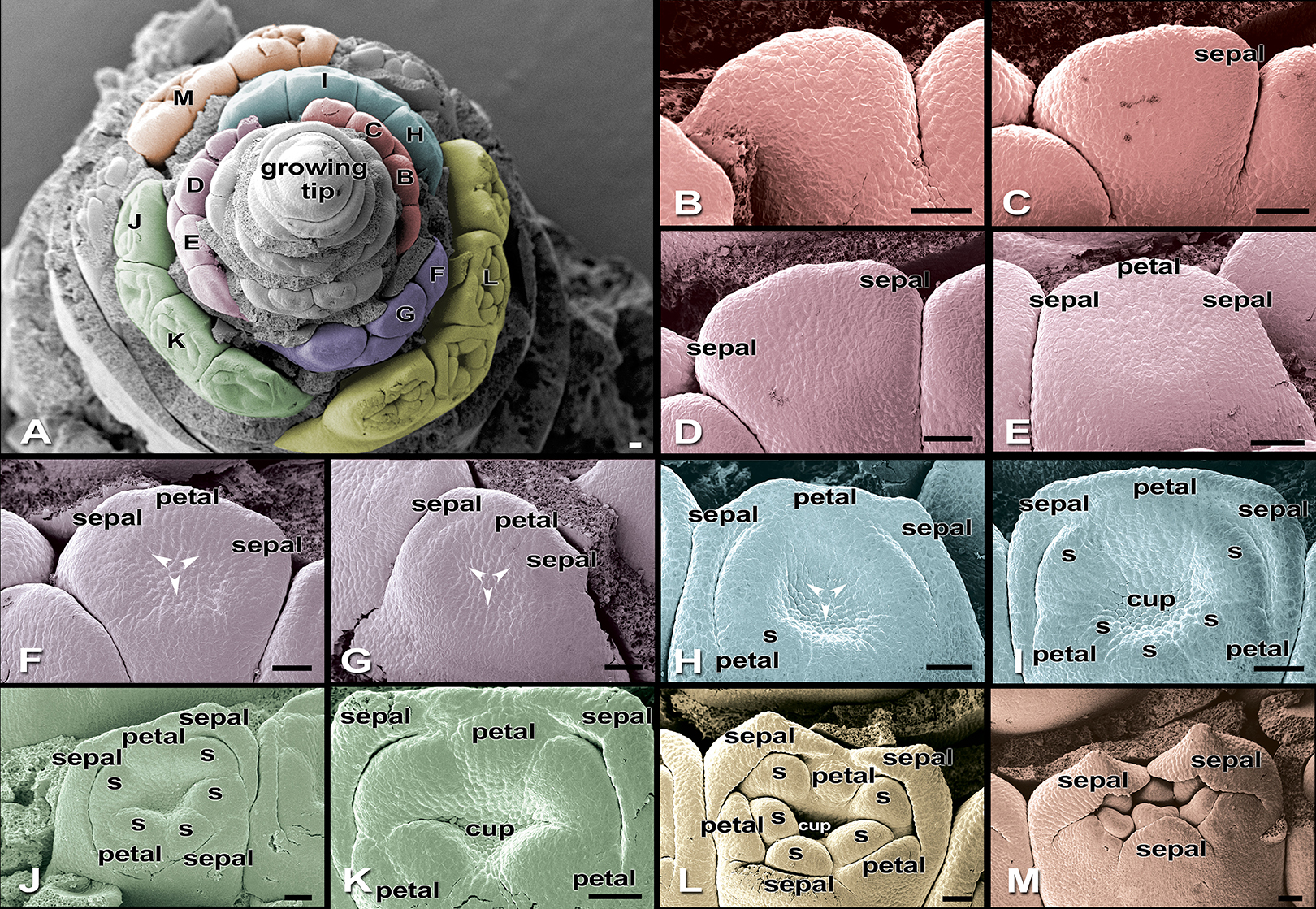 Figure 5 - The formation of the flower parts can be seen in these pictures of young flowers of the hairy banana.