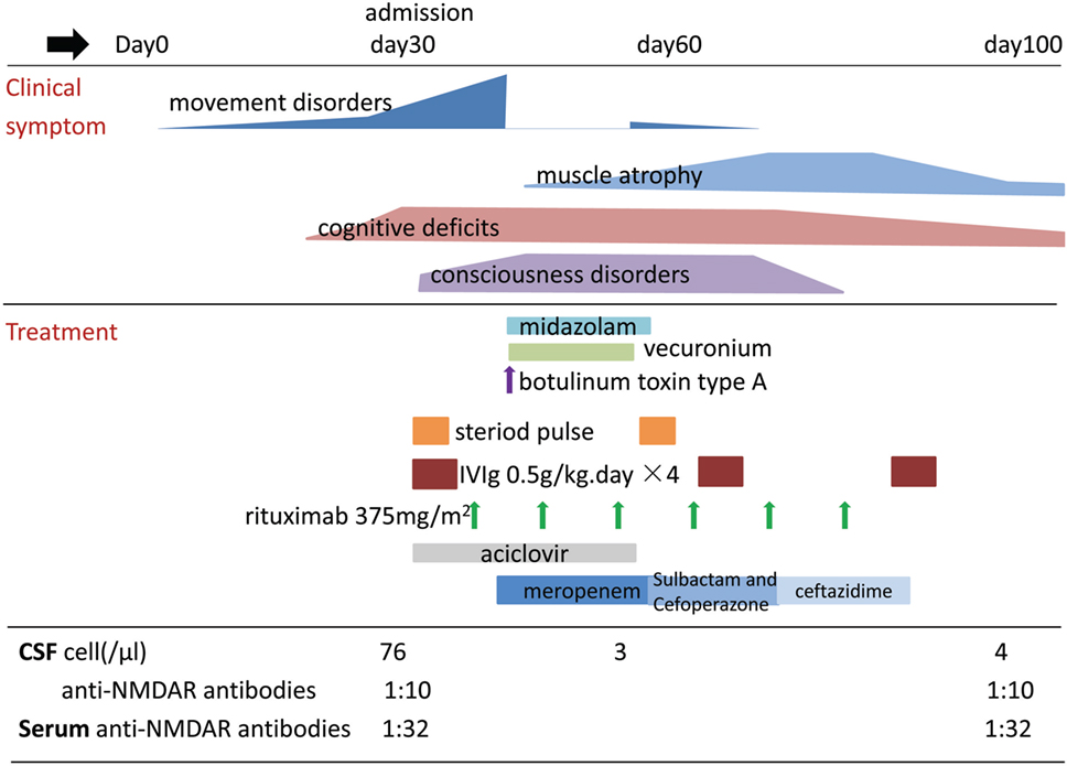 nmda treatment