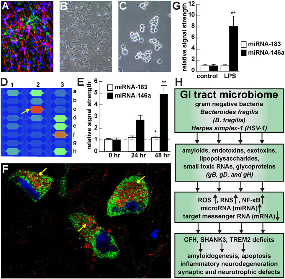 Frontiers - Microbiome-Mediated Upregulation of MicroRNA-146a in Sporadic Alzheimer