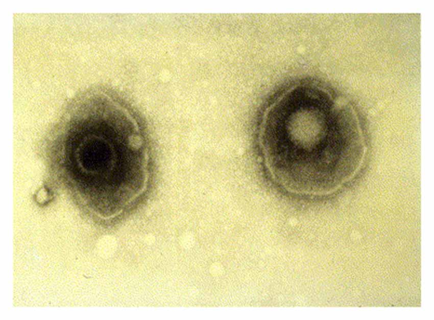 Virus herpes simpleks