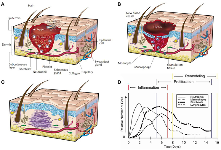 Wound Dressing: From Nanomaterials to Diagnostic Dressings and Healing  Evaluations