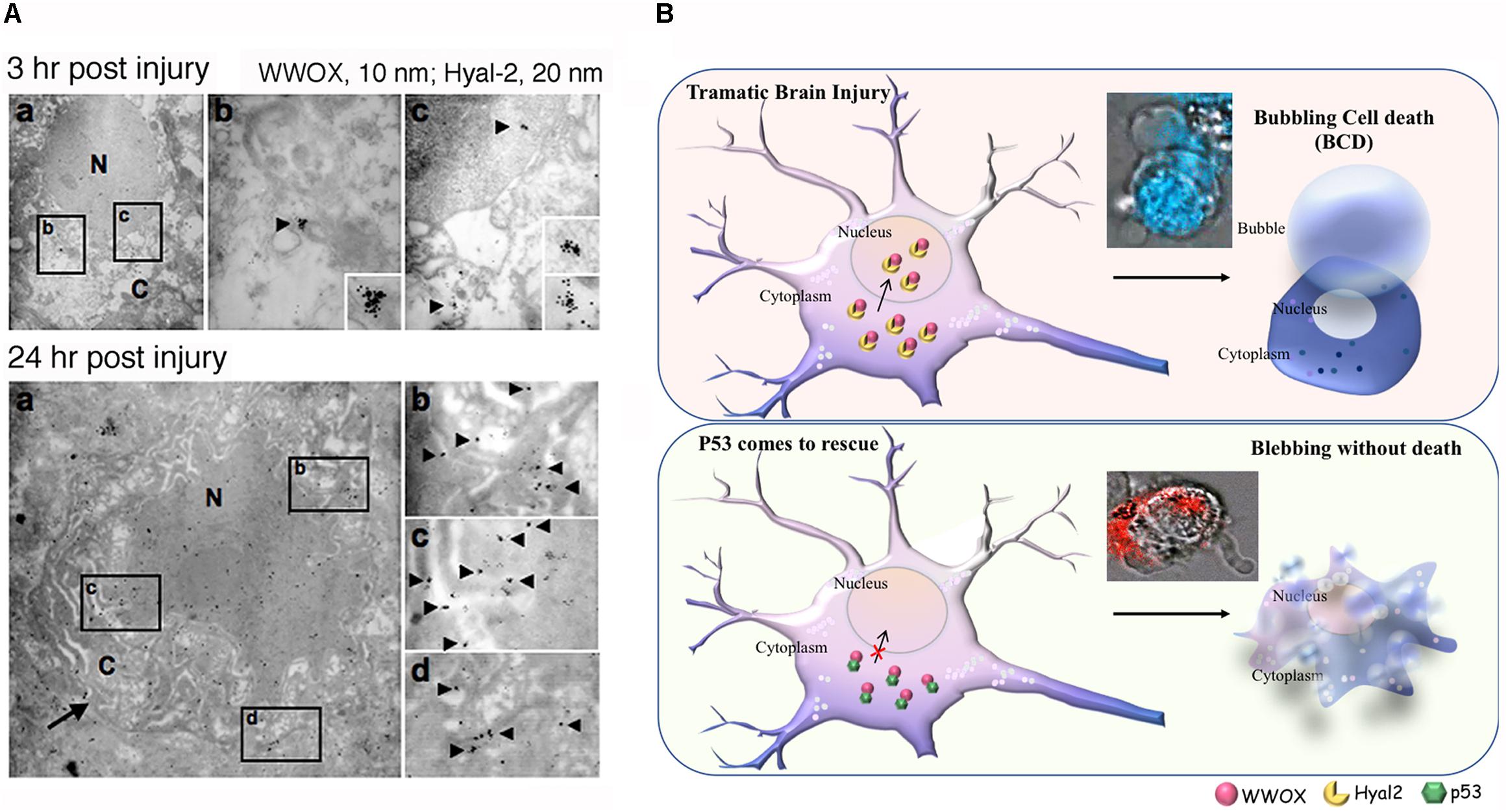 The Role of Bubbles in Brain Injury