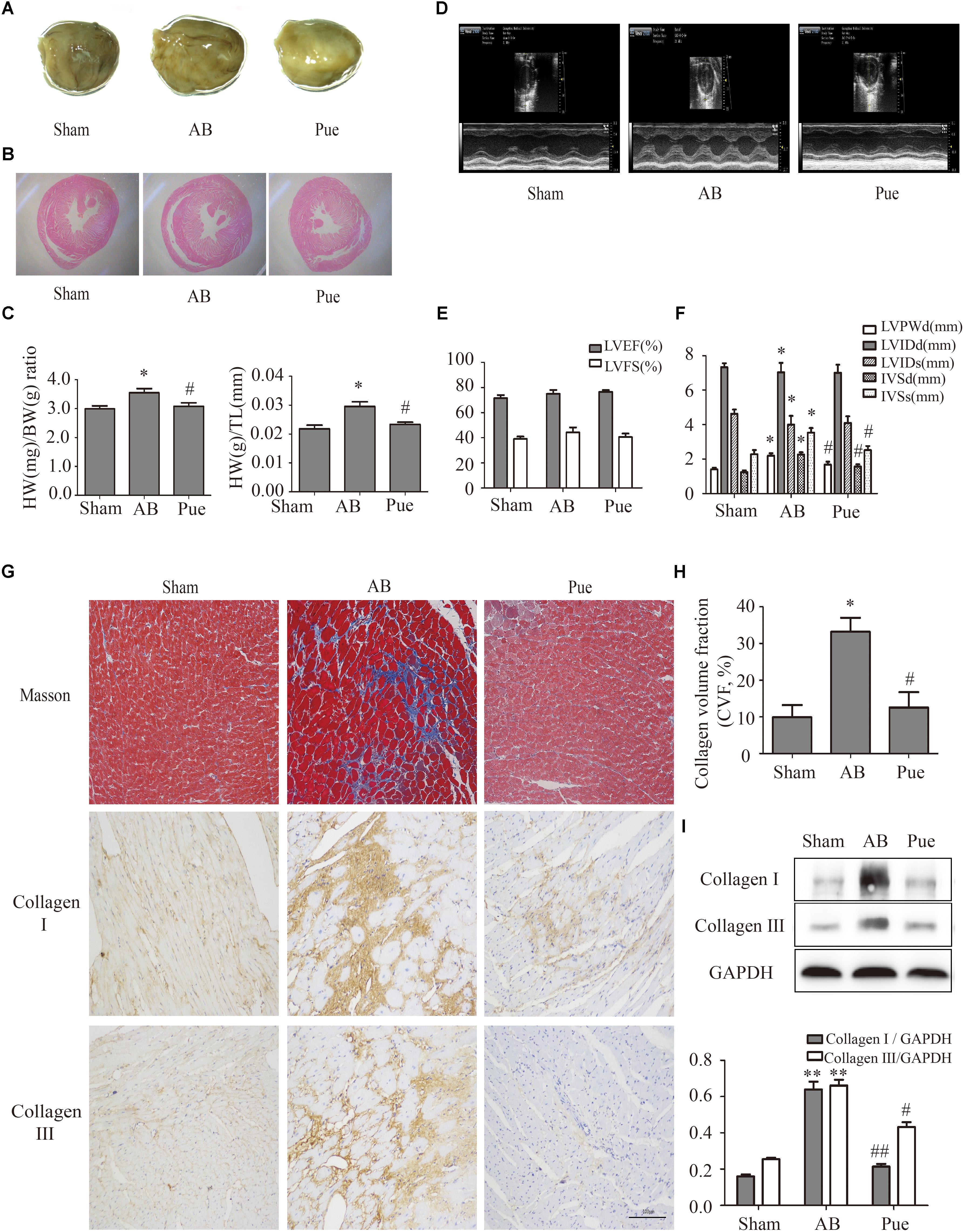 Frontiers Nrf2 Is A Key Regulator On Puerarin Preventing Cardiac Fibrosis And Upregulating Metabolic Enzymes Ugt1a1 In Rats Pharmacology