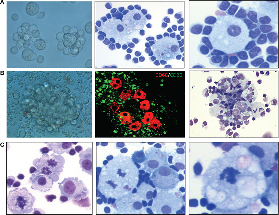 experimental mesothelioma treatment