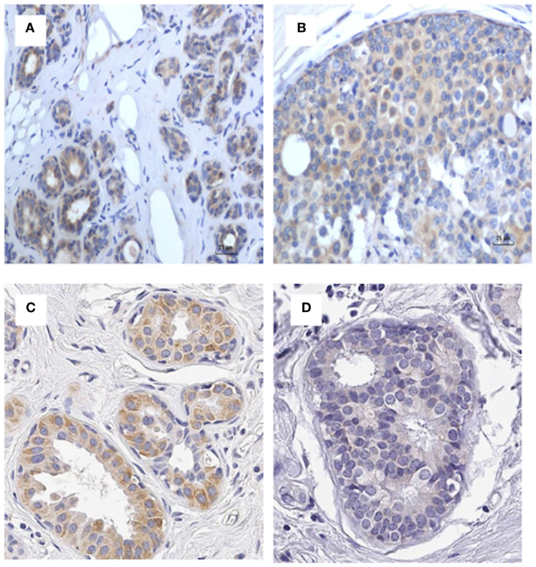 Frontiers | Association of Mouse Mammary Tumor Virus With