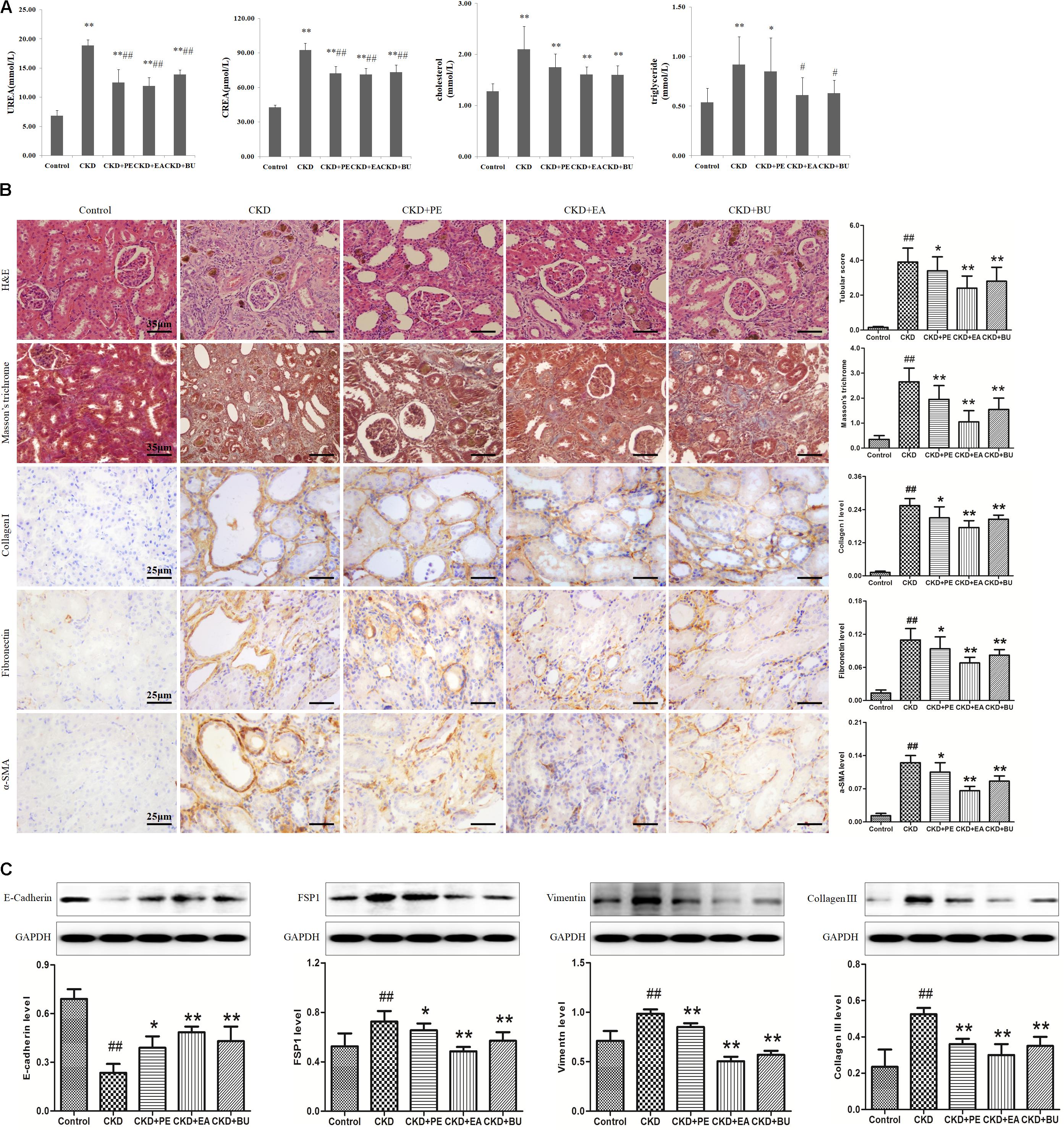 Frontiers Rhubarb Protect Against Tubulointerstitial Fibrosis By Inhibiting Tgf B Smad Pathway And Improving Abnormal Metabolome In Chronic Kidney Disease Pharmacology