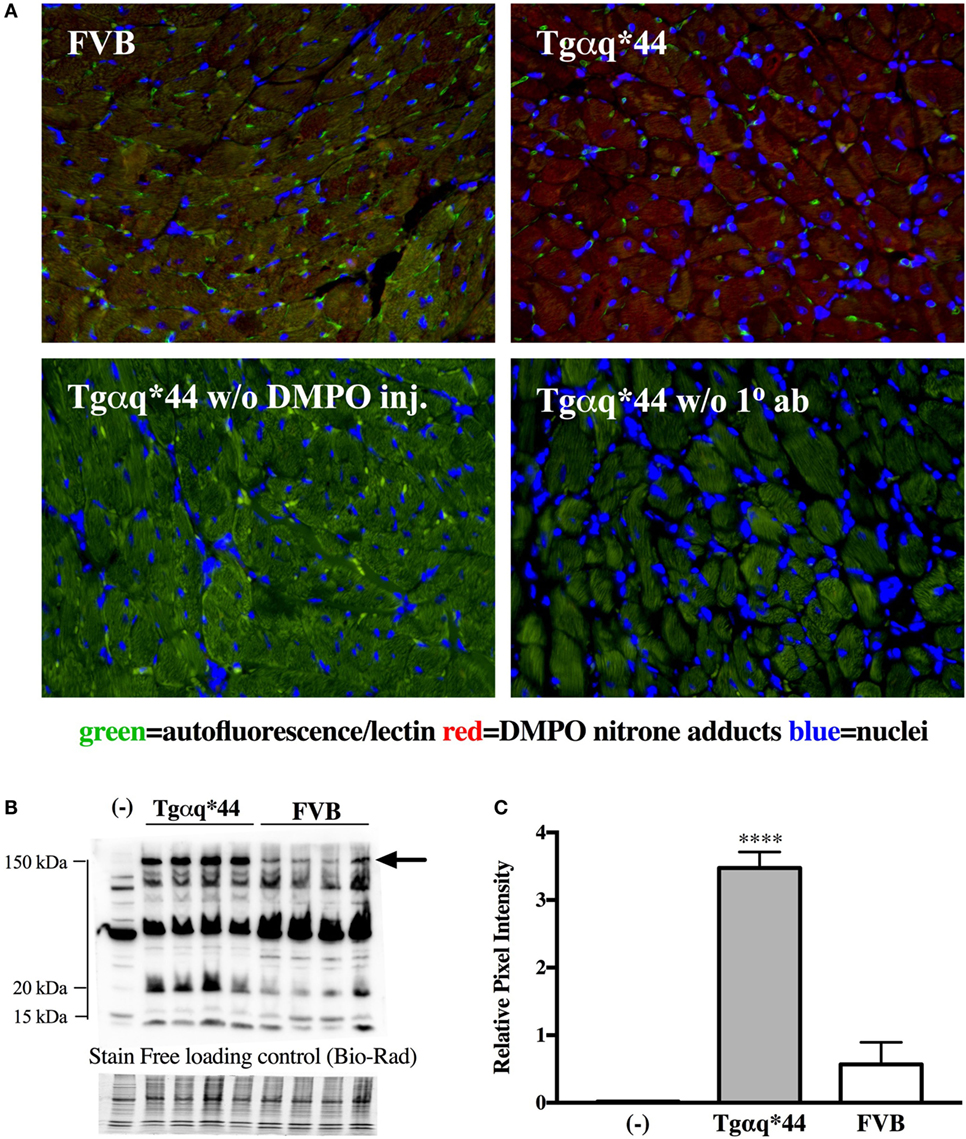 lsm.jpg4.us | imagesize: lsd-017" Frontiers | Immuno-Spin Trapping-Based Detection of Oxidative Modifications  in Cardiomyocytes and Coronary Endothelium in the Progression of Heart  Failure in Tgαq*44 Mice