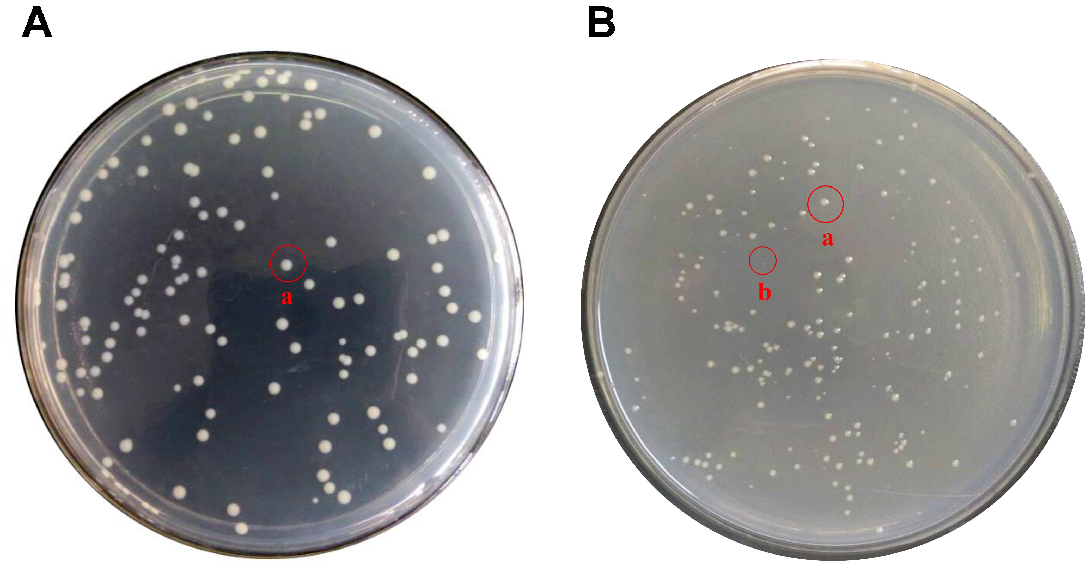 Coli sotwe. Escherichia coli серогруппы. БЛРС Escherichia coli это. Кишечная палочка o157. Escherichia coli в чашке Петри.