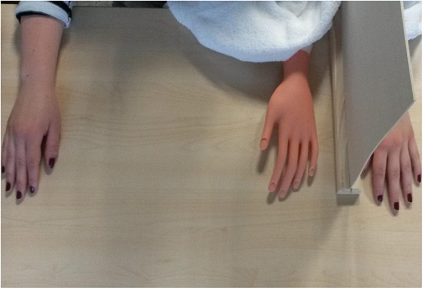 Frontiers  Verbal Suggestion Modulates the Sense of Ownership and Heat  Pain Threshold During the “Injured” Rubber Hand Illusion